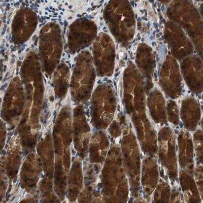 Immunohistochemistry: ZNF18 Antibody [NBP1-81758]
