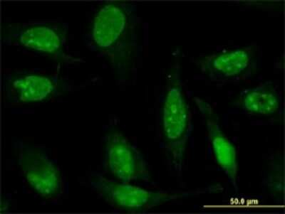 Immunocytochemistry/ Immunofluorescence: ZNF181 Antibody (5F1) [H00339318-M01]