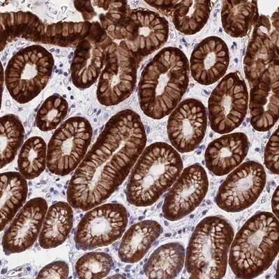 Immunohistochemistry-Paraffin: ZNF181 Antibody [NBP1-92618]