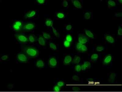 Immunocytochemistry/ Immunofluorescence: ZNF182 Antibody (6D11) [H00007569-M03]