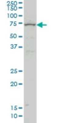 Western Blot: ZNF182 Antibody (6D11) [H00007569-M03]