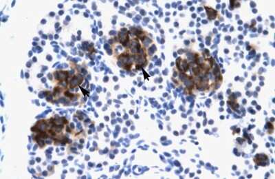 Immunohistochemistry-Paraffin: ZNF182 Antibody [NBP1-80024]