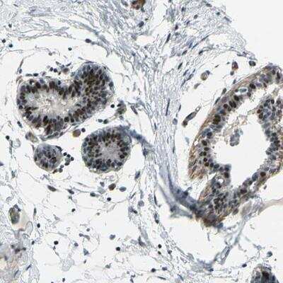 Immunohistochemistry: ZNF184 Antibody [NBP1-86159]