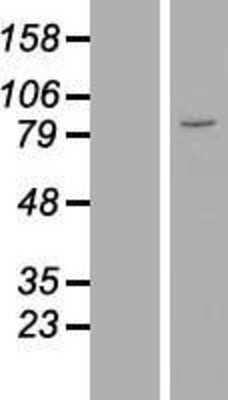 Western Blot: ZNF184 Overexpression Lysate [NBL1-18075]