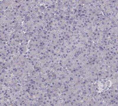 Immunohistochemistry-Paraffin: ZNF185 Antibody [NBP1-86452]