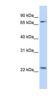 Western Blot: ZNF185 Antibody [NBP1-80320]