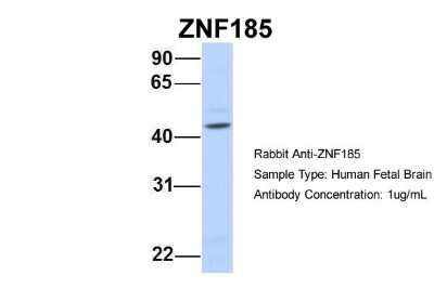 Western Blot: ZNF185 Antibody [NBP1-80320]