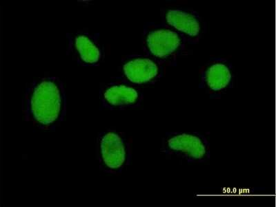 Immunocytochemistry/ Immunofluorescence: ZNF189 Antibody [H00007743-B01P]