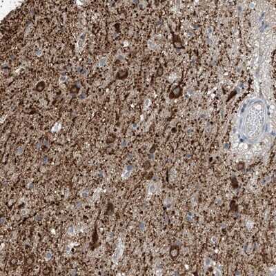Immunohistochemistry-Paraffin: ZNF189 Antibody [NBP1-85915]