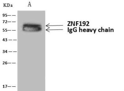 Immunoprecipitation: ZNF192 Antibody [NBP3-12709]