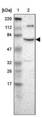 Western Blot: ZNF192 Antibody [NBP1-82840]