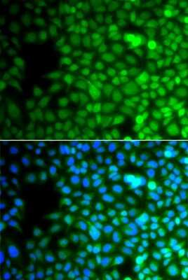 Immunocytochemistry/ Immunofluorescence: ZNF195 Antibody - BSA Free [NBP2-93054]