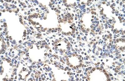 Immunohistochemistry: ZNF195 Antibody [NBP2-83833]