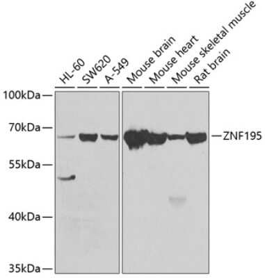 Western Blot: ZNF195 AntibodyBSA Free [NBP2-93054]
