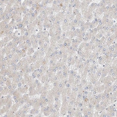 Immunohistochemistry-Paraffin: ZNF198 Antibody [NBP1-84685]