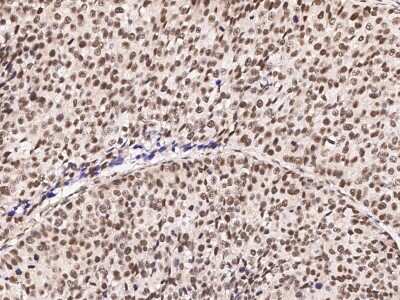 Immunohistochemistry-Paraffin: ZNF198 Antibody [NBP2-95284]