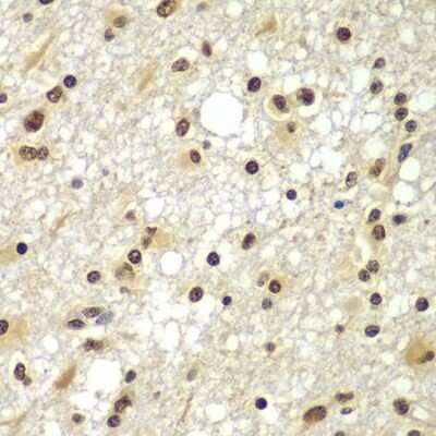 Immunohistochemistry-Paraffin: ZNF20 Antibody - BSA Free [NBP2-93053]