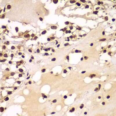 Immunohistochemistry-Paraffin: ZNF20 Antibody - BSA Free [NBP2-93053]