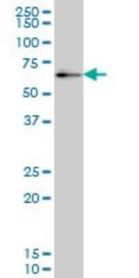 Western Blot: ZNF207 Antibody (6D6) [H00007756-M01]