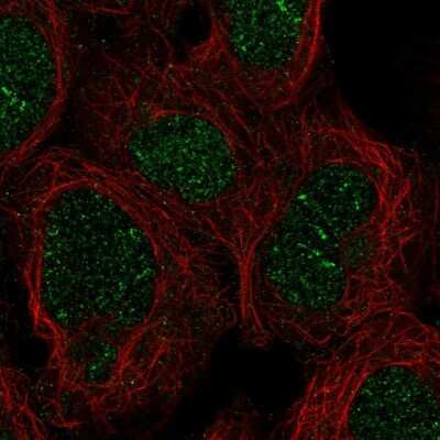 Immunocytochemistry/ Immunofluorescence: ZNF212 Antibody [NBP2-58705]
