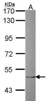 Western Blot: ZNF212 Antibody [NBP2-20975]