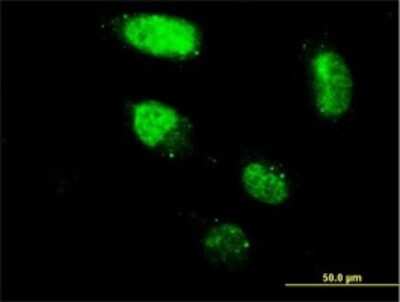 Immunocytochemistry/ Immunofluorescence: ZNF213 Antibody (3D3) [H00007760-M02]