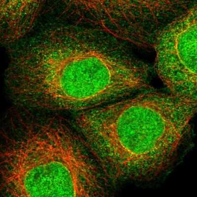 Immunocytochemistry/ Immunofluorescence: ZNF213 Antibody [NBP1-84386]