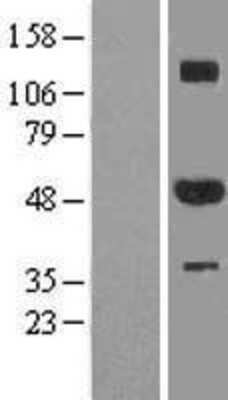 Western Blot: ZNF213 Overexpression Lysate [NBP2-09552]