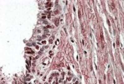 Immunohistochemistry-Paraffin: ZNF217 Antibody [NB100-41378]