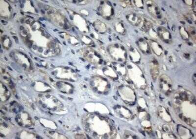 Immunohistochemistry: ZNF217 Antibody (OTI3G5) - Azide and BSA Free [NBP2-74933]