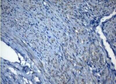 Immunohistochemistry: ZNF217 Antibody (OTI3G5) - Azide and BSA Free [NBP2-74933]