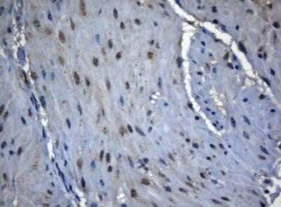 Immunohistochemistry: ZNF217 Antibody (OTI3G5) - Azide and BSA Free [NBP2-74933]