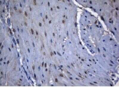 Immunohistochemistry: ZNF217 Antibody (OTI3G5) - Azide and BSA Free [NBP2-74933]