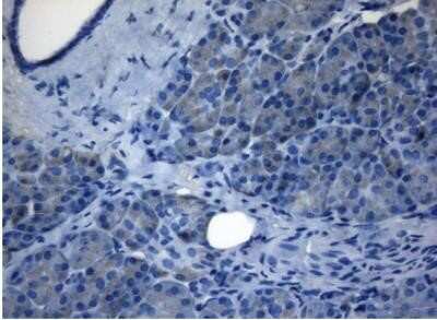 Immunohistochemistry: ZNF217 Antibody (OTI3G5) - Azide and BSA Free [NBP2-74933]