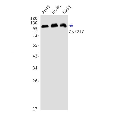 Western Blot: ZNF217 Antibody (S02-4B1) [NBP3-19928]