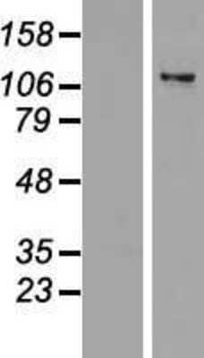 Western Blot: ZNF217 Overexpression Lysate [NBP2-07608]