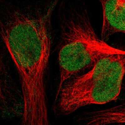 Immunocytochemistry/ Immunofluorescence: ZNF22 Antibody [NBP1-81739]