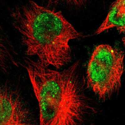 Immunocytochemistry/ Immunofluorescence: ZNF222 Antibody [NBP1-86148]
