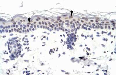 Immunohistochemistry: ZNF223 Antibody [NBP2-86458]