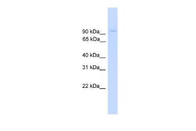 Western Blot: ZNF224 Antibody [NBP2-86461]