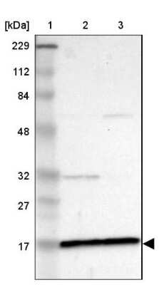 Western Blot: ZNF226 Antibody [NBP1-81632]