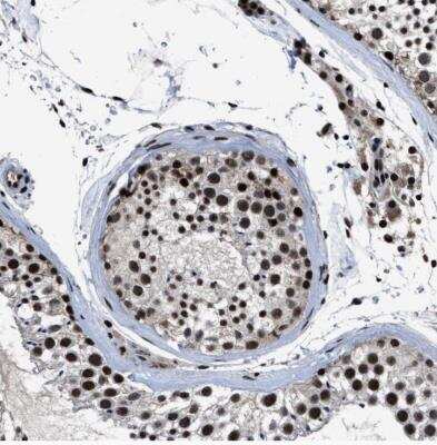 Immunohistochemistry-Paraffin: ZNF233 Antibody [NBP1-81942]