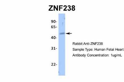 Western Blot: ZNF238 Antibody [NBP2-82381]