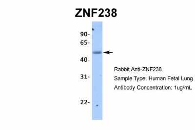 Western Blot: ZNF238 Antibody [NBP2-82381]