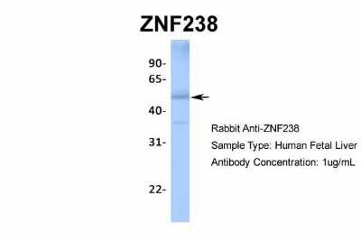 Western Blot: ZNF238 Antibody [NBP2-82381]