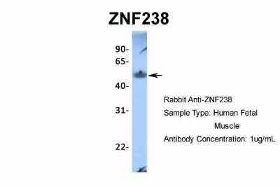Western Blot: ZNF238 Antibody [NBP2-82381]
