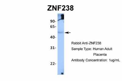 Western Blot: ZNF238 Antibody [NBP2-82381]