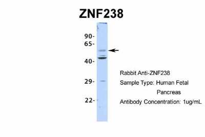 Western Blot: ZNF238 Antibody [NBP2-82381]