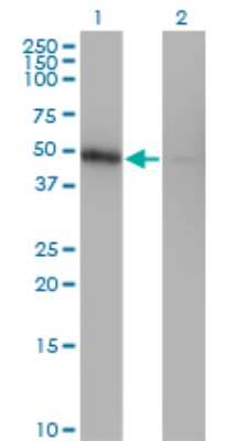 Western Blot: ZNF24 Antibody (4C2) [H00007572-M03]