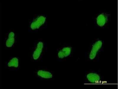 Immunocytochemistry/ Immunofluorescence: ZNF254 Antibody [H00009534-B01P]